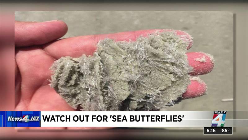 Sea butterflies poke beachgoers along Florida’s coast
