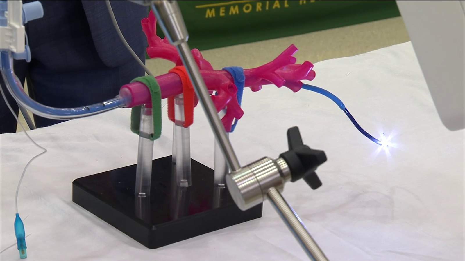 Memorial Hospital unveils new tool to diagnose lung cancer sooner