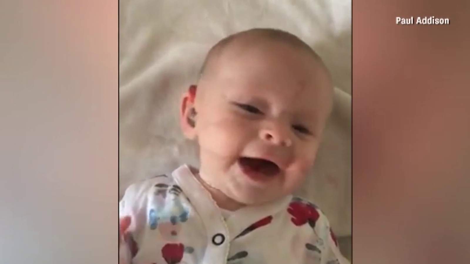 Viral video captures sound of joy when a baby’s hearing aid is turned on