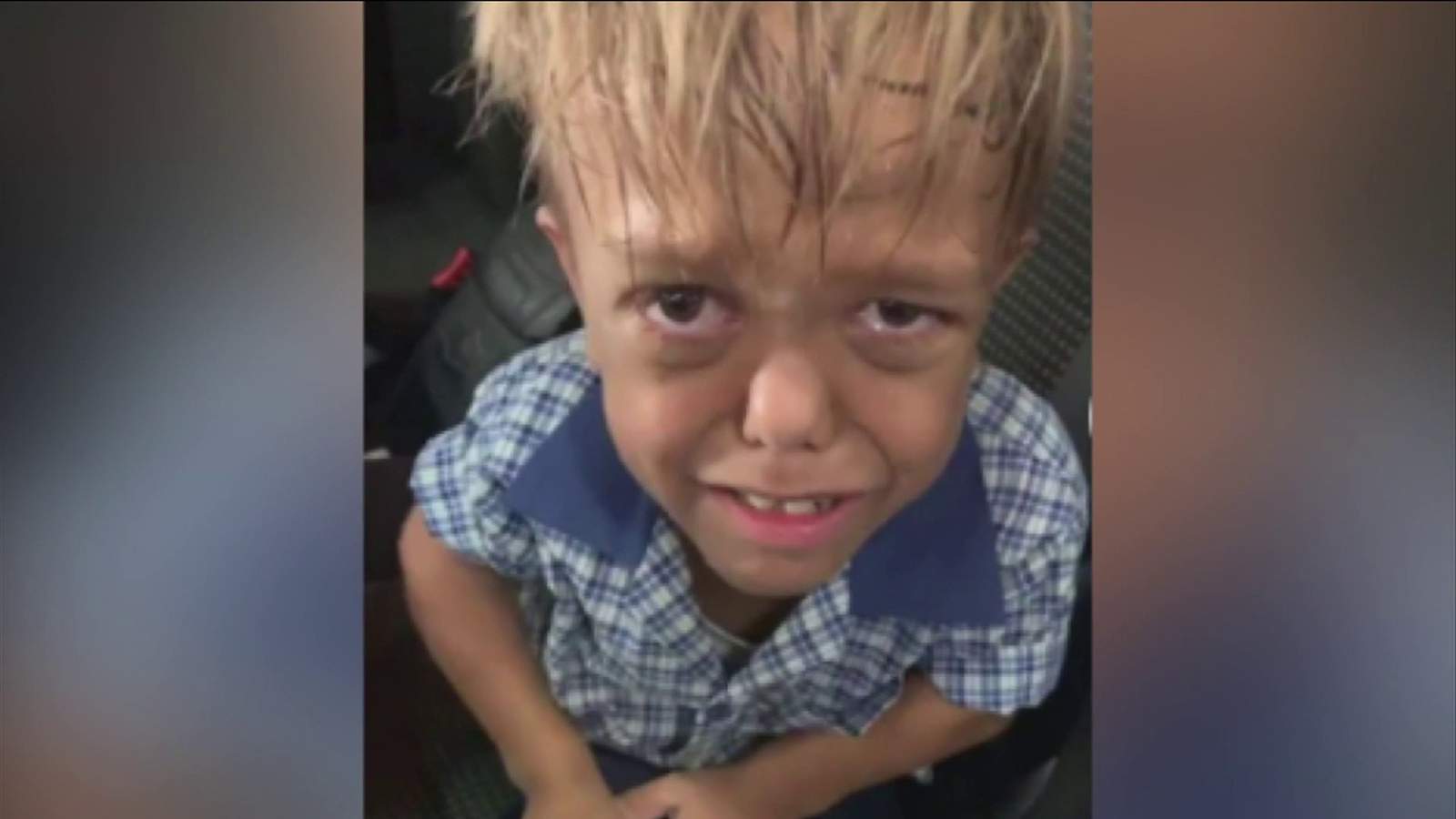 Mother’s heartbreaking video of son with dwarfism crying because of bullying goes viral