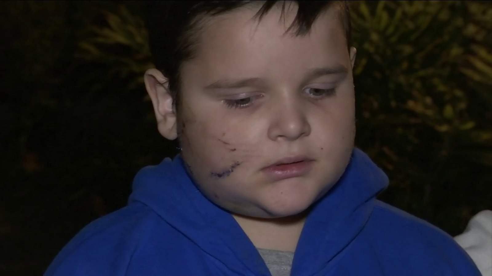 Mother asks for help after son mauled by dog