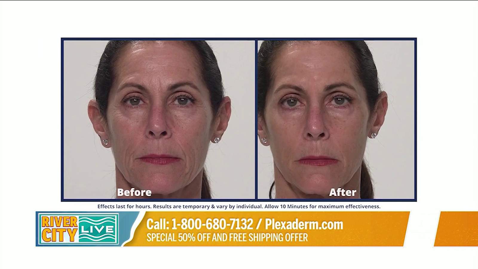 Get Rid of Under-Eye Bags with Plexaderm | River City Live