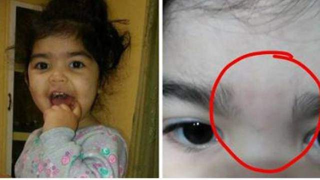 Washington women say toddlers' eyebrows were waxed