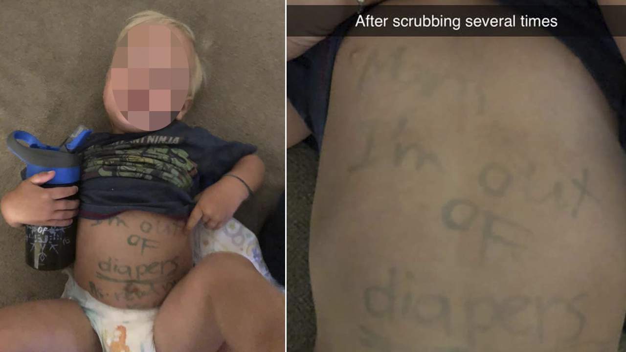 Florida mother says day care wrote on child’s tummy to remind her to bring diapers