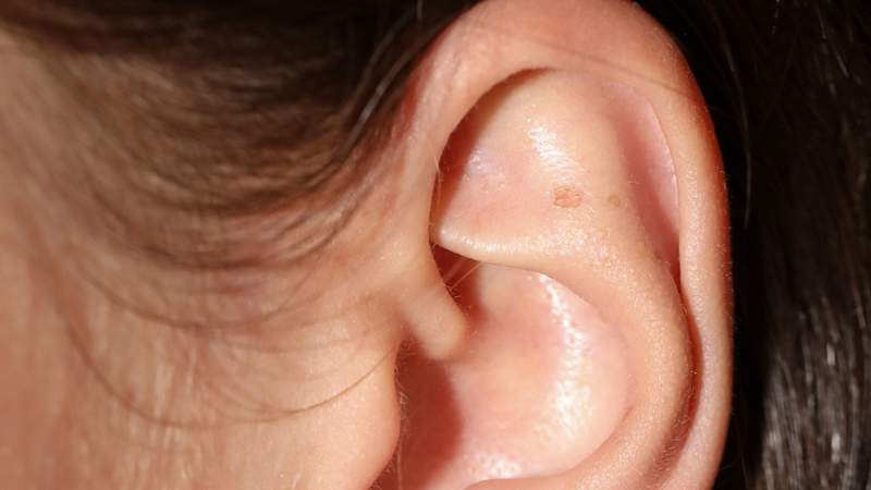 Hearing loss prevention: These tips aim to help people of all ages