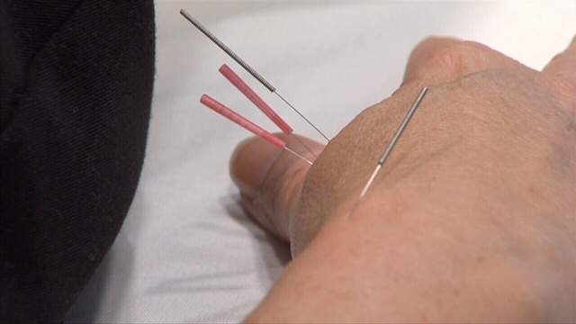 Is acupuncture helpful for easing cancer pain?